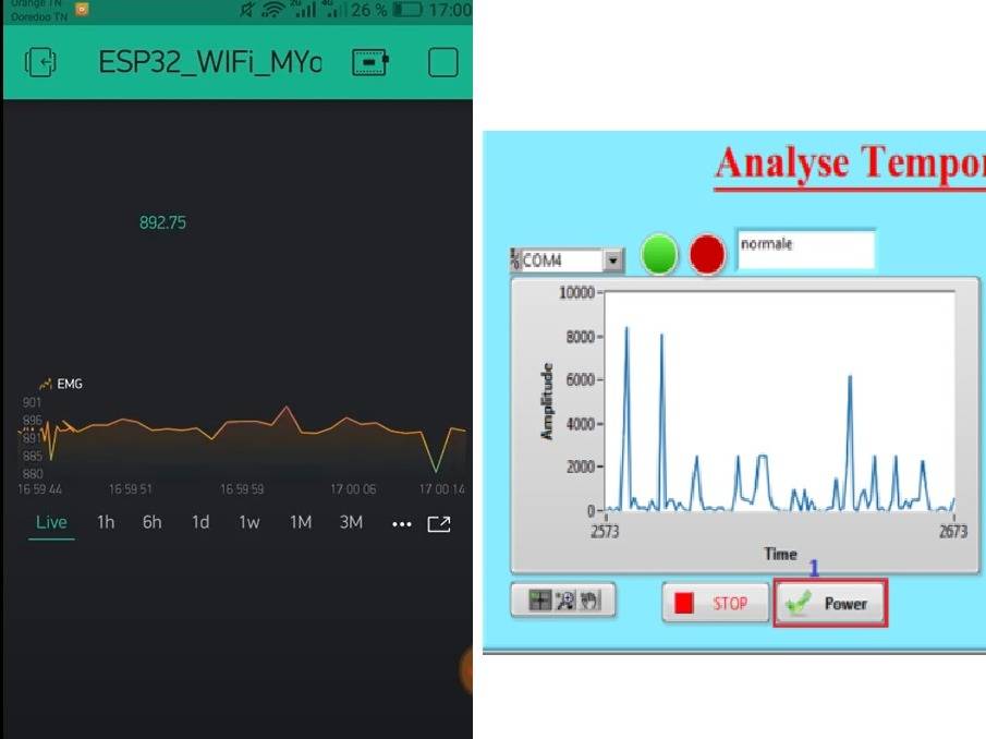Development of an EMG signal acquisition and supervision interfac..